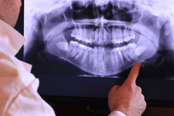 Best Emergency Denture Repair in Edgewood, NM
