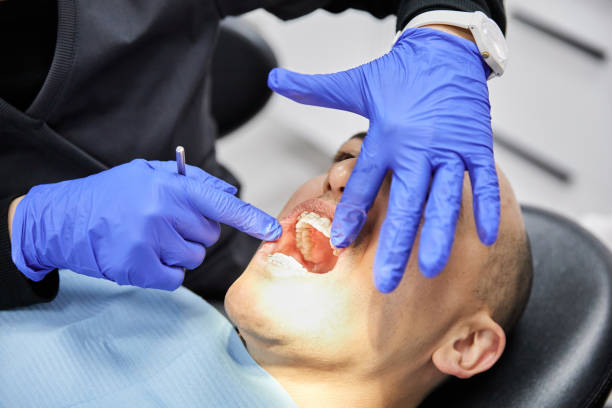 Best Emergency Wisdom Teeth Removal in Edgewood, NM